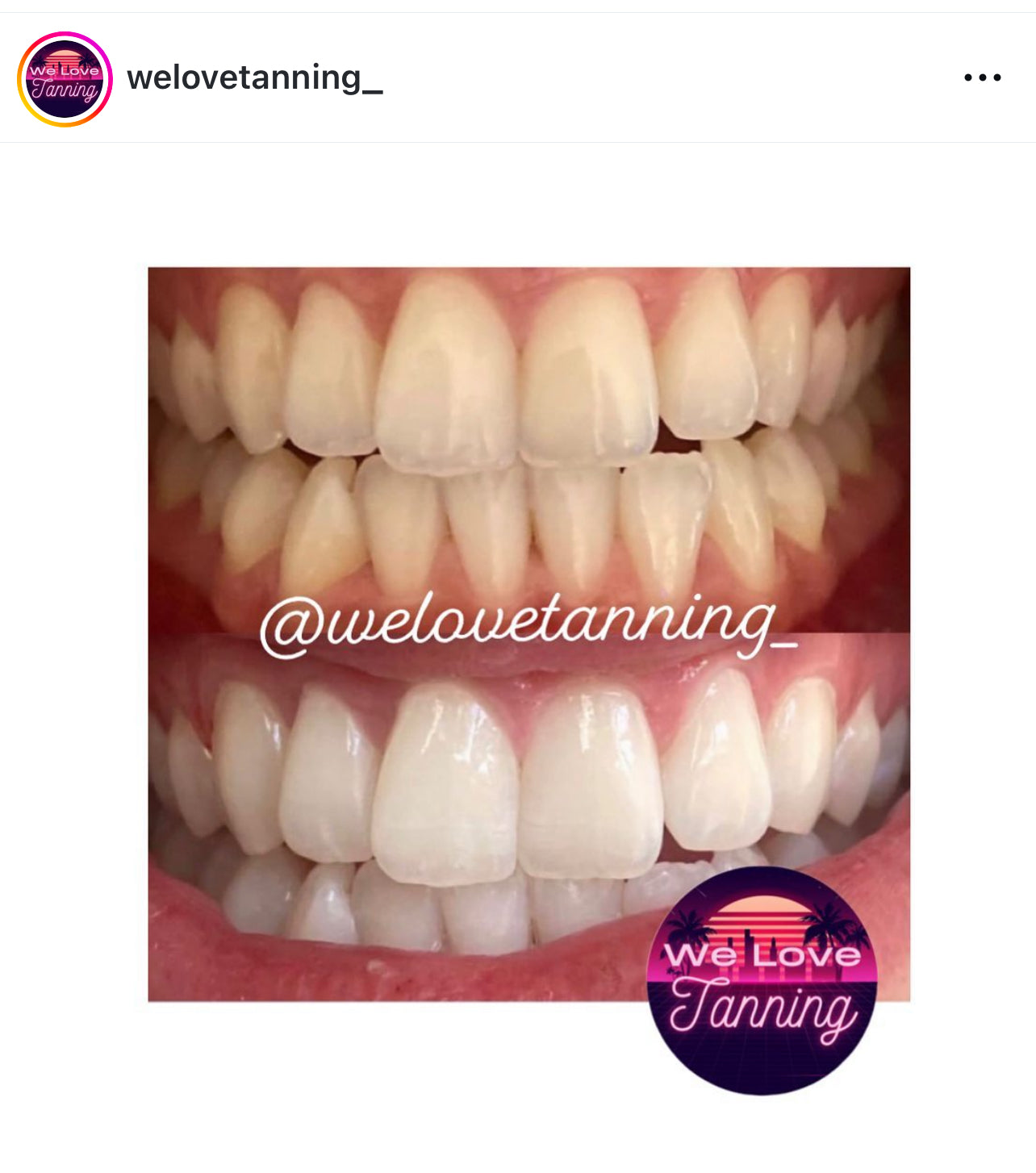 Sunbed Teeth Whitening Pen 4ml